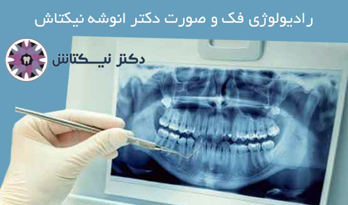 رادیولوژی فک و صورت در اسلامشهر
